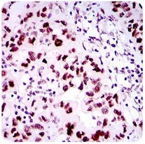 Monoclonal Mouse anti-Human TP53BP1 / 53BP1 Antibody (clone 6B3E10, aa500-800, IHC, WB)