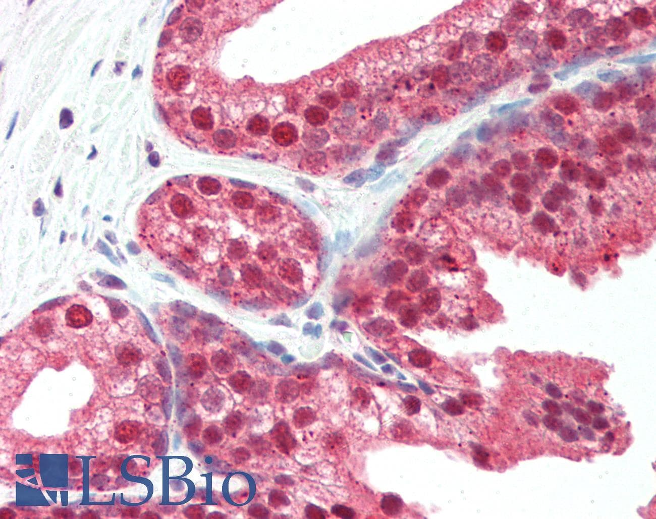 IHC-plus™ SLITRK4 Antibody