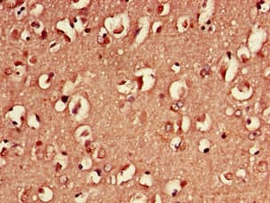 YWHAH / 14-3-3 Eta Antibody (Biotin)