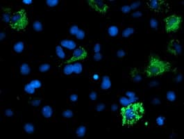 ACSM5 / MACS3 Antibody (clone OTI1G1)