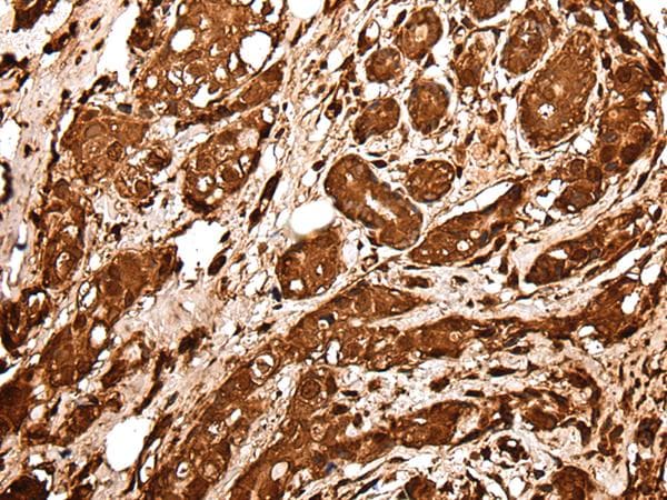 VCP Antibody