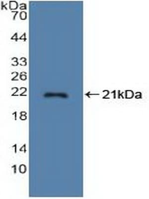 STMN1 / Stathmin / LAG Antibody (aa2-149, PE)