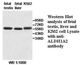 RALDH2 / ALDH1A2 Antibody (aa210-465)