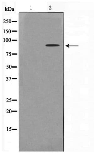HNRPM / HNRNPM Antibody