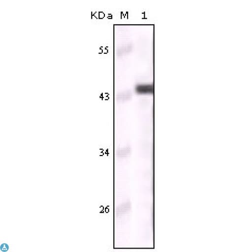 KRT5 / CK5 / Cytokeratin 5 Antibody
