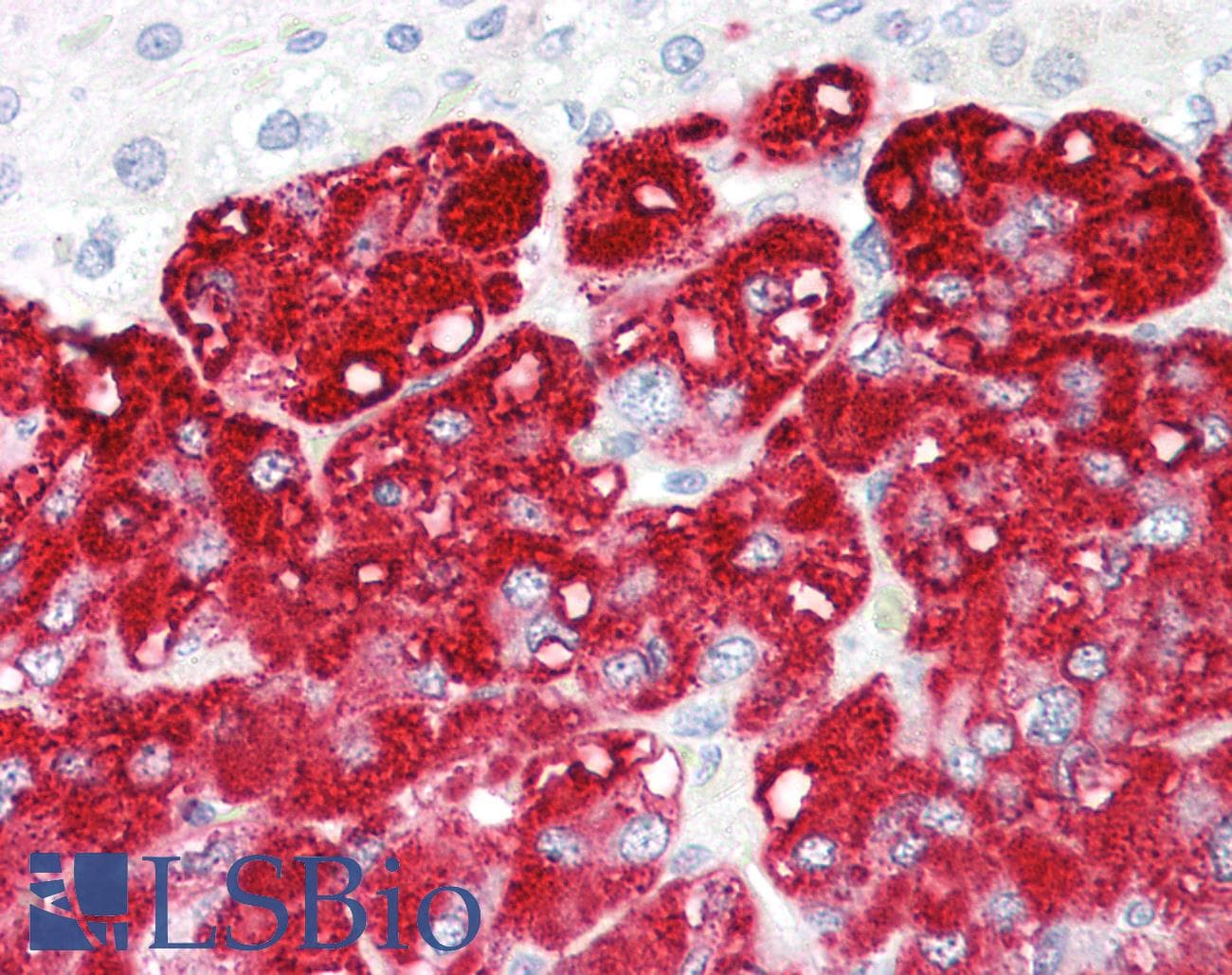 RNF139 / TRC8 Antibody (aa72-121)