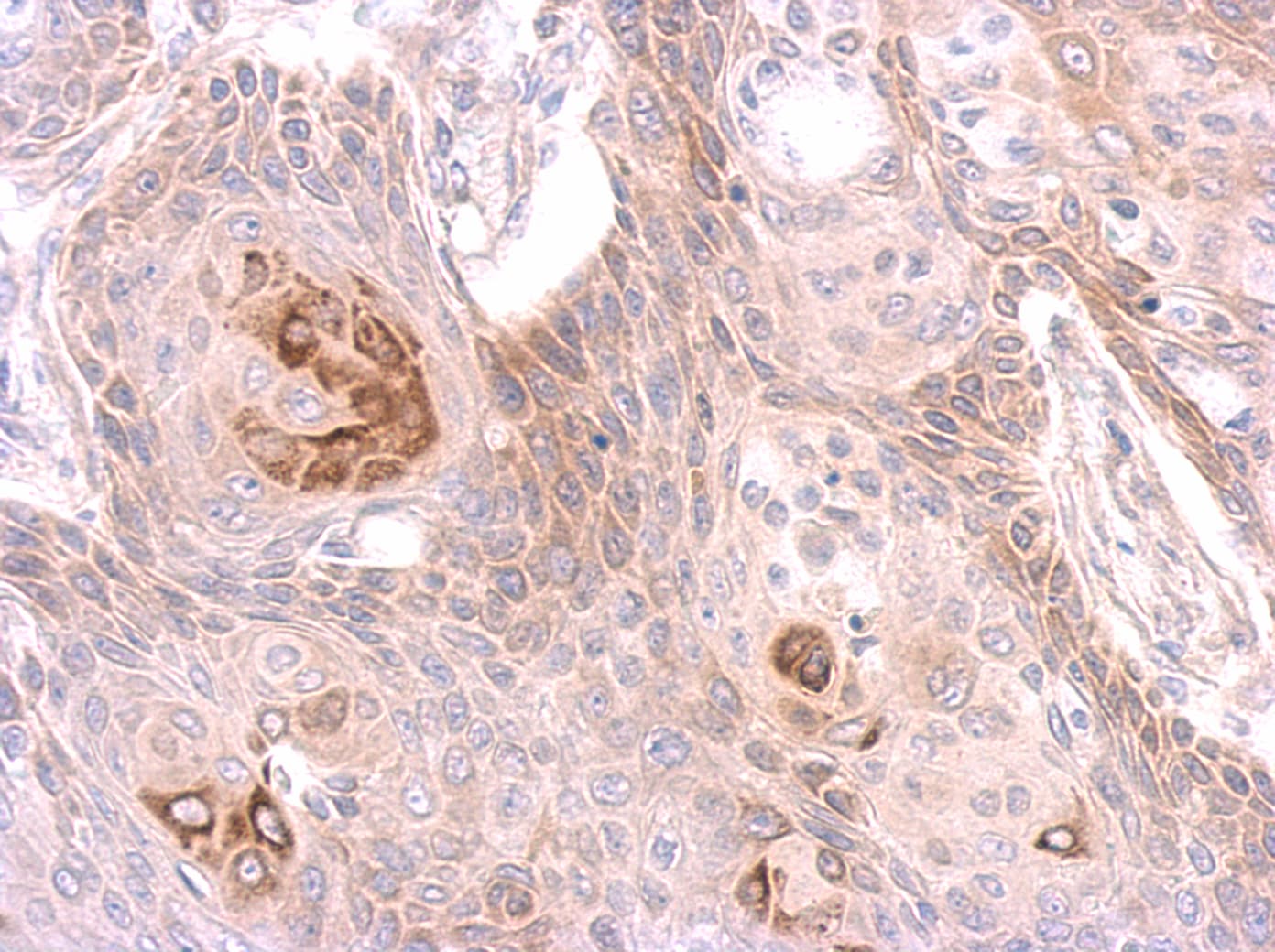 STK26 / MST4 Antibody (aa134-319)