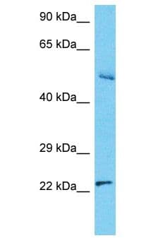 RNF187 Antibody (aa154-203)