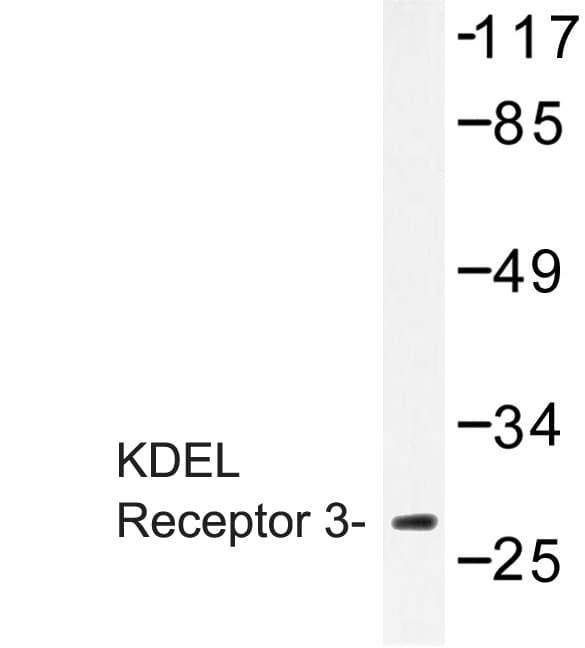 Polyclonal Rabbit anti-Human KDELR3 Antibody (Leu95, IHC, WB)