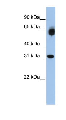 DHRS2 / HEP27 Antibody (aa108-157)