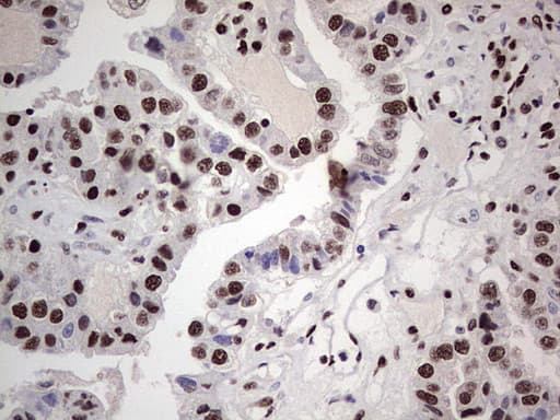 SAE1 Antibody (clone OTI3C3)