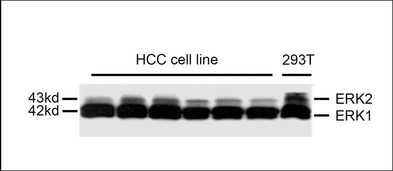 MAPK3 / ERK1 Antibody (clone 784CT7.6.3)