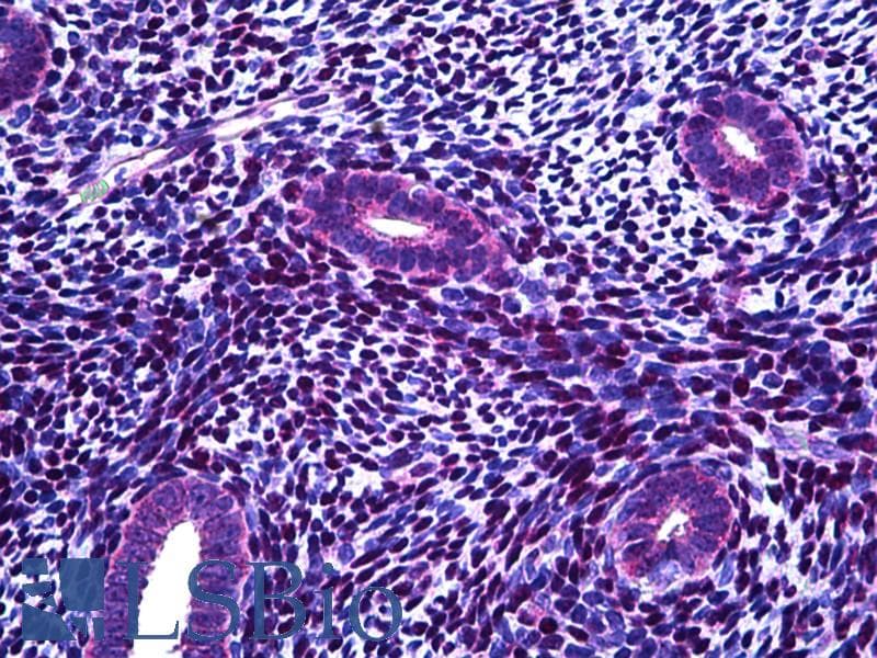 IHC-plus™ Polyclonal Rabbit anti-Human FANCA Antibody (aa1121-1170, IHC)