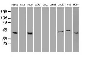 PathPlus™ Monoclonal Mouse anti-Human KRT19 / CK19 / Cytokeratin 19 Antibody (clone 3F8, IHC, IF, WB)