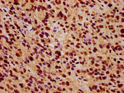 Polyclonal Rabbit anti-Human ZNF224 Antibody (IHC, IF)