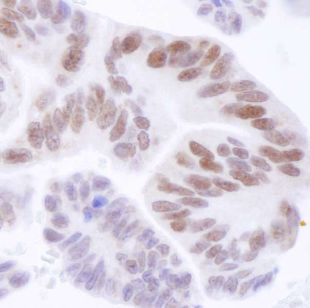 Polyclonal Rabbit anti-Human ASH2L / ASH2 Antibody (aa575-C-term, IHC)