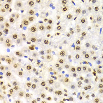 Histone H3 Antibody (Tri-Methyl-Lys9)