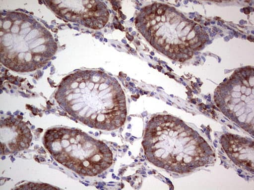 Monoclonal Mouse anti-Human LGALS3 / Galectin 3 Antibody (clone OTI2F1, Carrier-free, IHC, WB)