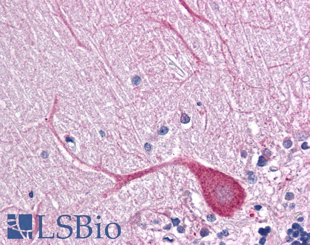 IHC-plus™ TLR3 Antibody