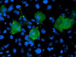 LIMK1 / LIMK Antibody (clone OTI6A7)