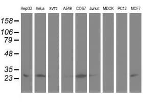 AK4 / Adenylate Kinase 4 Antibody (clone OTI5E7, Carrier-free)