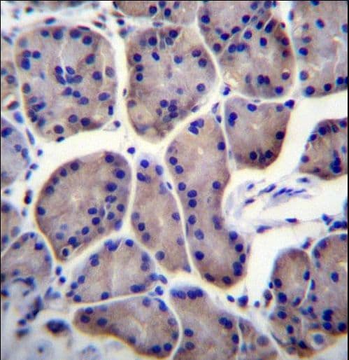 RPL23 / Ribosomal Protein L23 Antibody (aa49-78)