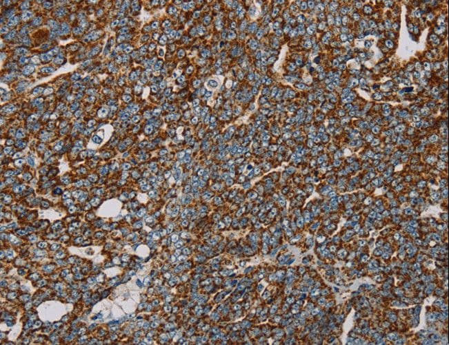 Polyclonal Rabbit anti-Human NDUFS3 Antibody (IHC, WB)
