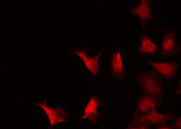 MYC / c-Myc Antibody (phospho-Thr58)