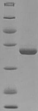 Mouse PDXP / Pyridoxal Phosphatase Protein (Recombinant 6His, N-terminus)