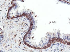 PFKP Antibody (clone OTI3G8, Carrier-free)