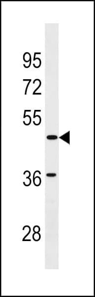 Polyclonal Rabbit anti-Human SGCE Antibody (aa351-379, WB)