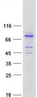Human CCDC138 Protein (Recombinant Myc-DDK (Flag))