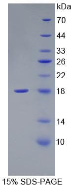 Mouse FN1 / Fibronectin Protein (Recombinant His, N-Terminal)