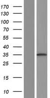 RAD51 / RECA Protein (Over-Expression Lysate Myc-DDK (Flag))