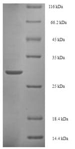 Salmonella typhimurium iagB Protein (Recombinant 6His-SUMO, N-terminus)