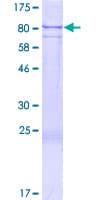 Human SNED1 Protein (Recombinant GST)