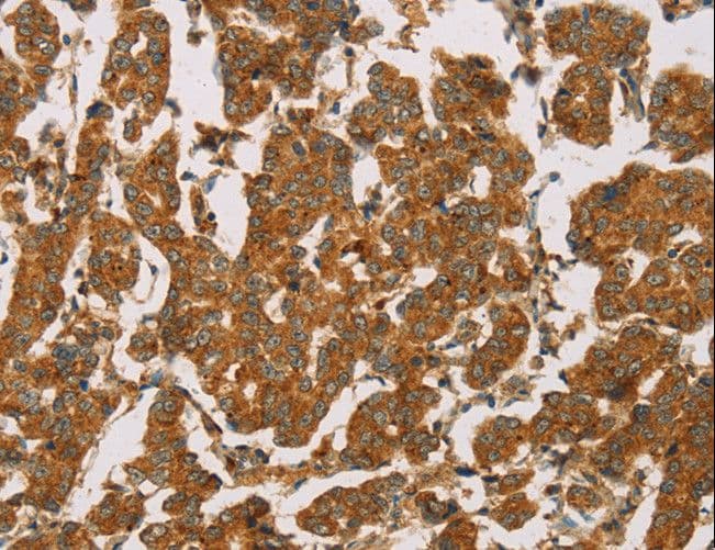 IHC-plus™ Polyclonal Rabbit anti-Human DLL4 Antibody (IHC)