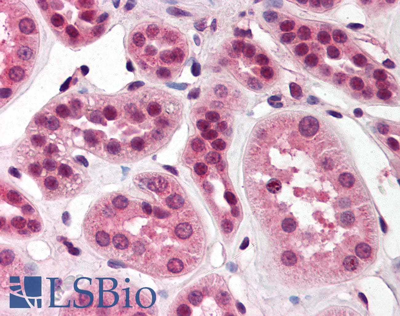 IHC-plus™ SKI Antibody