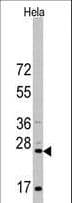 CD8A / CD8 Alpha Antibody (aa59-88)