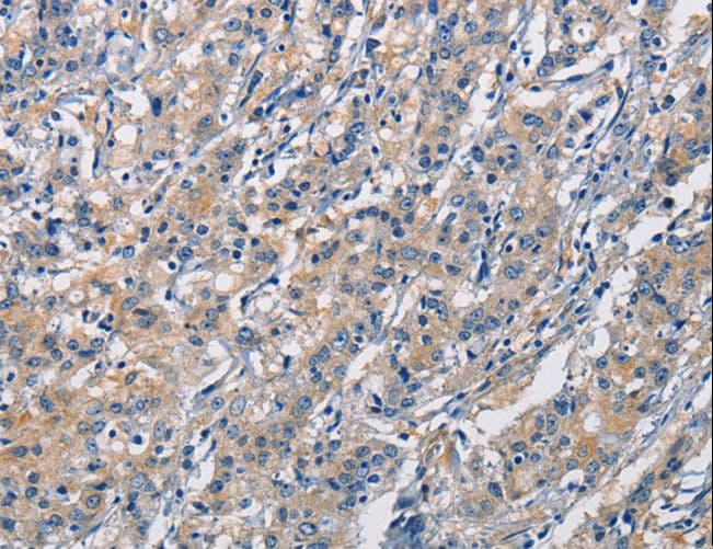 CRTAM Antibody