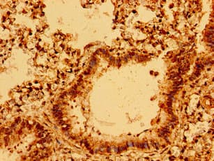 C11orf9 / MRF Antibody