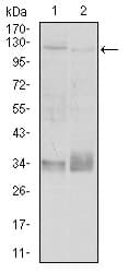 ITGB1 / Integrin Beta 1 / CD29 Antibody (clone 3B6B2)