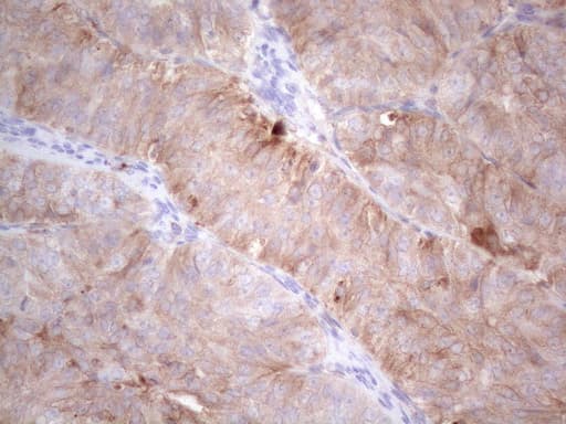 LPIN1 / Lipin 1 Antibody (clone OTI7F5, Carrier-free)
