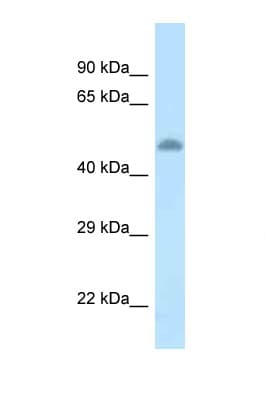 Polyclonal Rabbit anti-Rat Tyrosine Aminotransferase Antibody (aa361-410, WB)