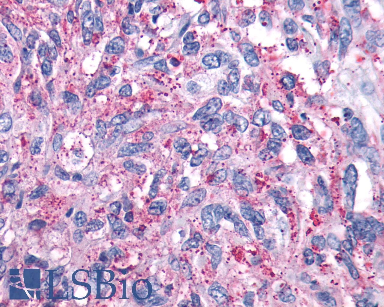 PathPlus™ GRM4 / MGLUR4 Antibody (N-Terminus)