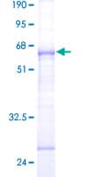Human EIF4E2 / IF4e Protein (Recombinant GST)