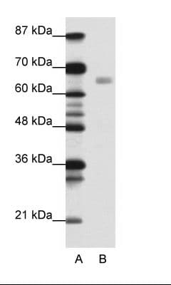 Polyclonal Rabbit anti-Human HSF1 Antibody (C-Terminus, IHC, WB)