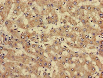 Polyclonal Rabbit anti-Human Antithrombin-III Antibody (IHC, WB)