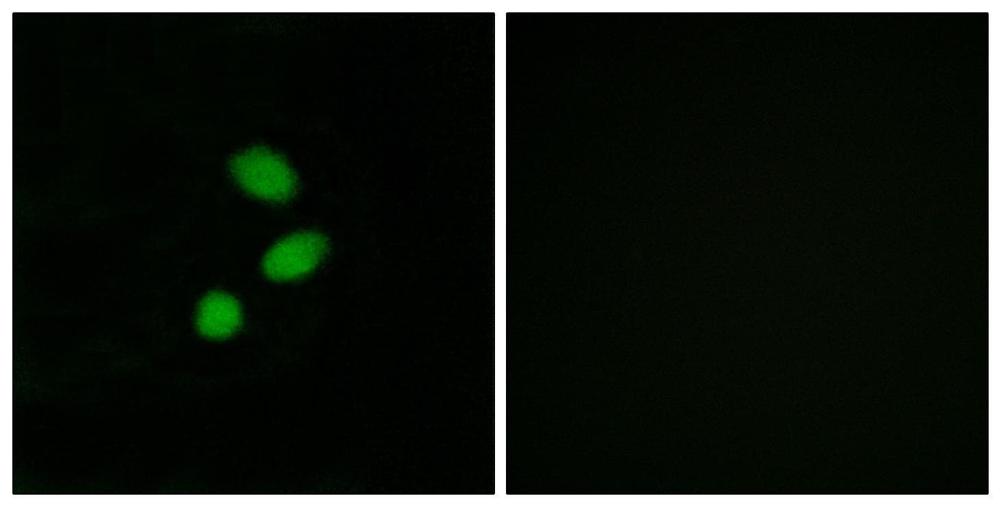 TSHZ2 Antibody
