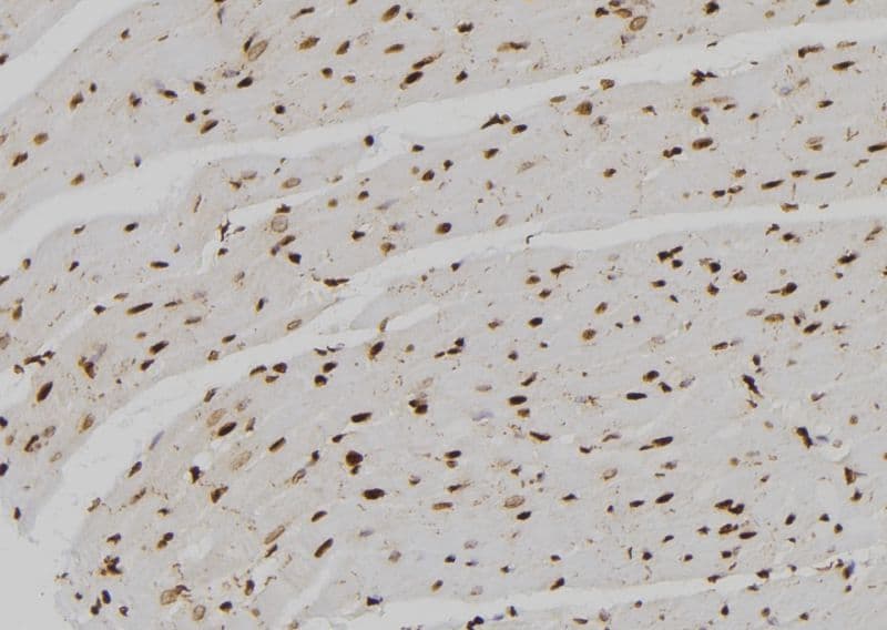 Polyclonal Rabbit anti-Human SNAPC4 Antibody (IHC, WB)